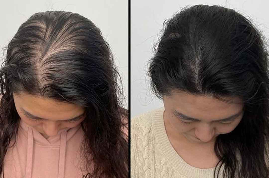 tonico-de-gengibre-antes-e-depois4